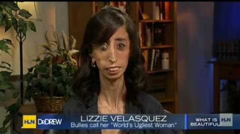 Lizzie Velasquez Answers Bullies Who Branded Her The World S Ugliest Woman Pictures