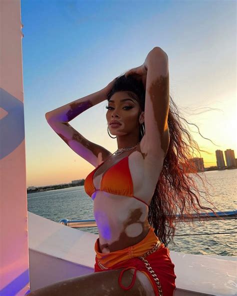 Winnie Harlow Spread Her Legs Wide In Tiny Bikini 21 Photos The Fappening