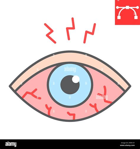 Eye sore color line icon, disease and allergy, eye redness vector icon ...