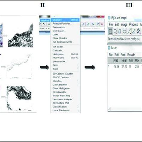 Quantification Of Total Collagen Fibres Distributed In Human Colon Download Scientific Diagram