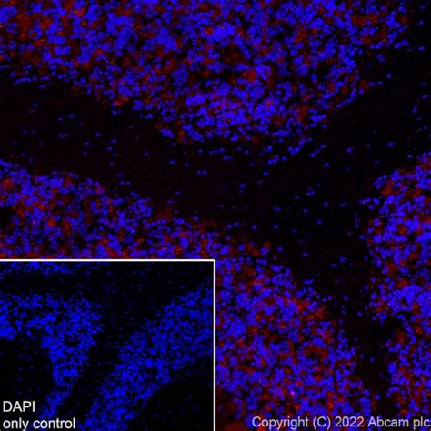 Recombinant Alexa Fluor® 594 Anti Gad65 Antibody [epr22952 70] Ab302656