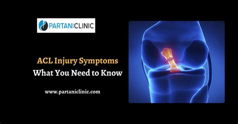 ACL Injury Symptoms: What You Need to Know | Partani Clinic