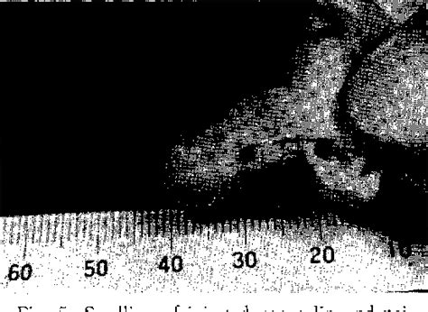 Figure 5 From The Nude Mouse As An Experimental Lepromatous Leprosy Model Continued The NFS N
