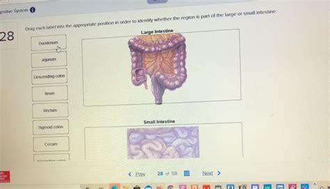 Solved Place The Following Organs Of The Digestive Tract In