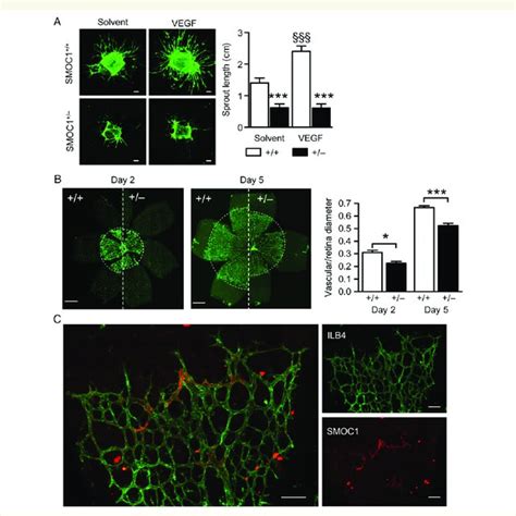 Consequences Of Smoc Down Regulation On Angiogenesis A Endothelial