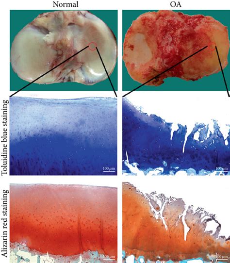 Staining And Identification Of Cartilage Tissue And Cells A