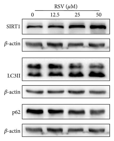 Resveratrol Increased The Expression Of SIRT1 And Enhanced Autophagic