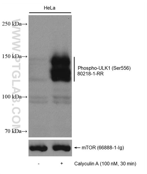 Phospho Ulk1 Ser556 Antibody 80218 1 Rr Proteintech 武汉三鹰生物技术有限公司