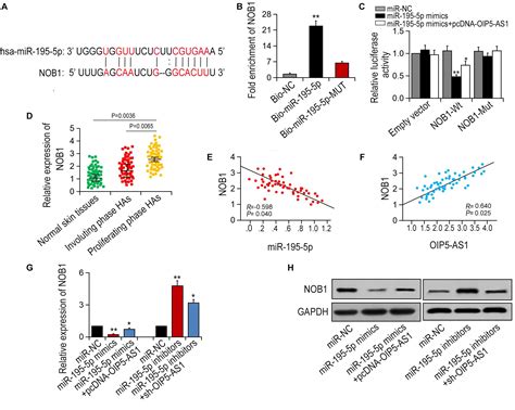 Frontiers Lncrna Oip As Promotes The Proliferation Of Hemangioma