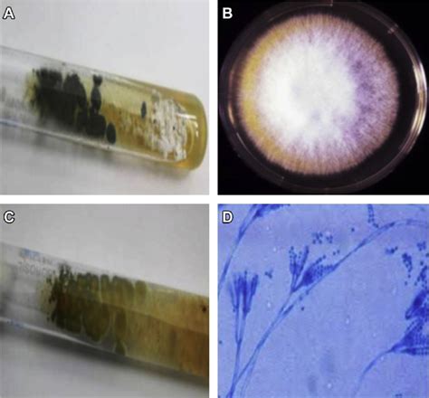 A Obverse View Of Penicillium Sp On Potato Dextrose Agar Pda