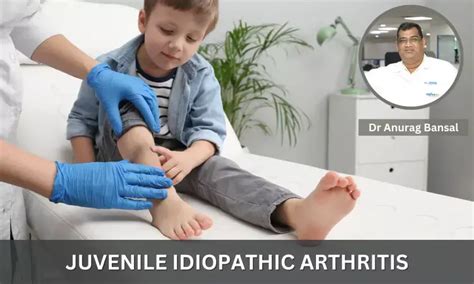 Juvenile Idiopathic Arthritis Symptoms Diagnosis And Treatment Dr