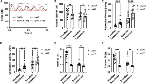 Pde3 Inhibition Ameliorates Restrictive Cardiomyopathy Phenotype In Ect