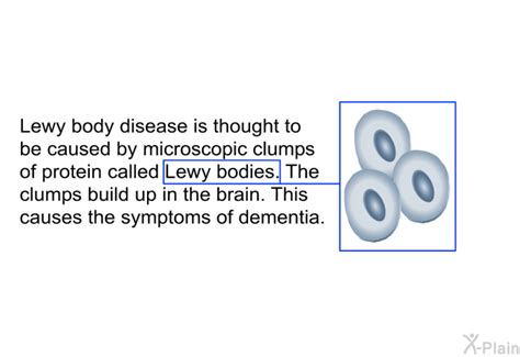 PatEdu.com : Lewy Body Disease