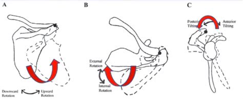 Sternoclavicular Joint Disorders Physiopedia