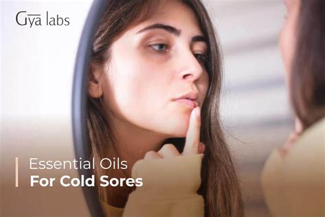 6 Top Essential Oils To Treat Cold Sores Naturally