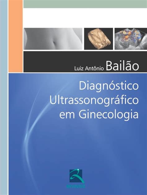 Ultraeduc Diagn Stico Ultrassonogr Fico Em Ginecologia