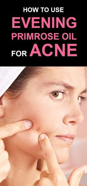 How To Get Rid Of Acne Fast With Evening Primrose Oil By Wellnessmgz4 Medium