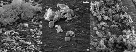 Scanning Electron Microscopy Of Malassezia Cells On Polyurethane