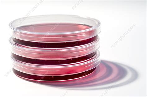 Cell Cultures In Petri Dishes Stock Image C003 7070 Science Photo