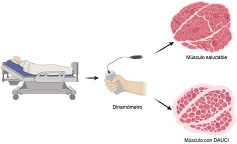 Evaluaci N De La Fuerza Muscular Por Dinamometr A De Prensi N Manual En