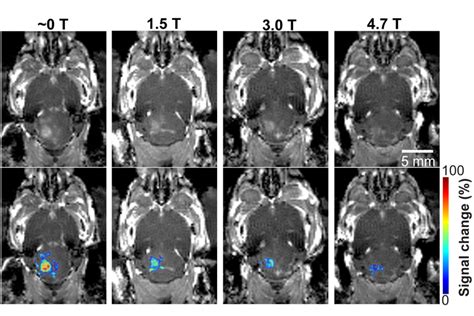 Mris Magnetic Field Affects Focused Ultrasound Technology Mirage News