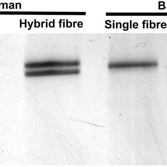 Separation Of The Myosin Heavy Chain MHC Isoforms Of Human And Baboon