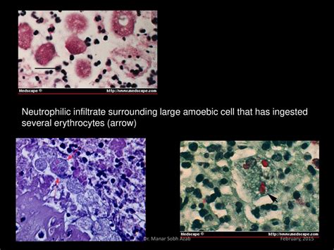 Morphology Trophozoite Pre Cyst Cyst Dr Manar Sobh Azab Ppt Download