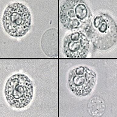 Urine Microscopy Flashcards | Quizlet