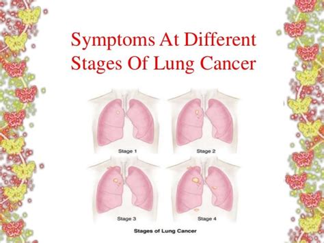 Symptoms at different stages of lung cancer