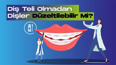 Diş Teli Nedir Kaç Yaşında Takılır Dikkat Edilmesi Gerekenler ve Diş