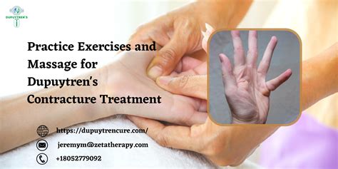 Practice Exercises and Massage for Dupuytren's Contracture Treatment by ...