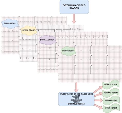 Figure 1 From Preliminary Study Based On Myocardial Infarction