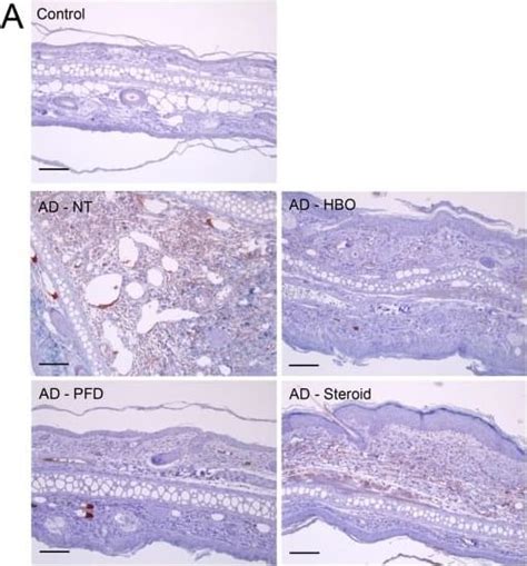 HIF 1 Alpha Antibody NB100 449 Bio Techne