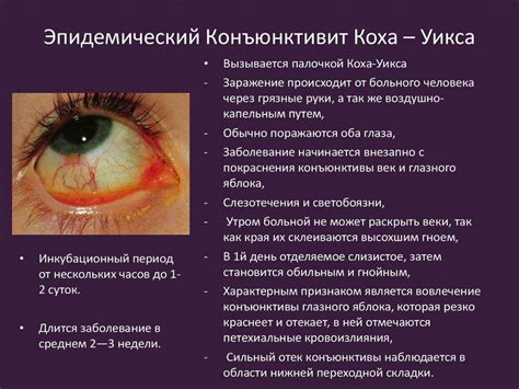 Конъюнктивит: фото, симптомы и лечение у взрослых в домашних условиях
