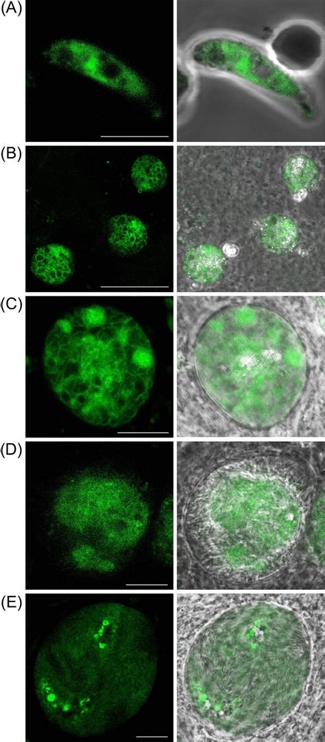 Expression Of KCR In P Berghei Confocal GFP Fluorescence And