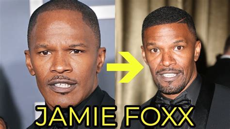 Jamie Foxx Hairline