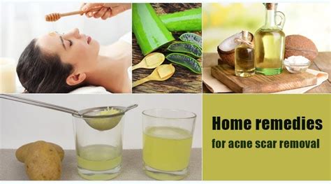 Home remedies for acne scar removal | by Tentaran Health | Medium