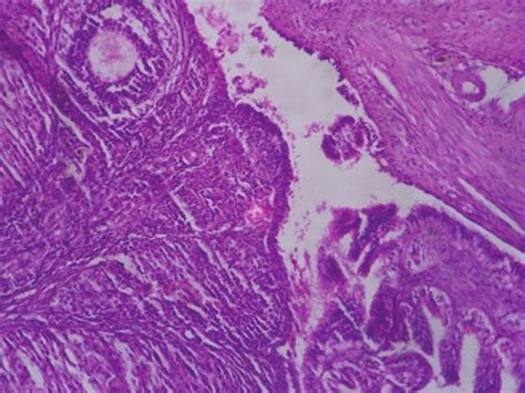 Photomicrograph Of Ovary Showing Mild Congestion H And E Group