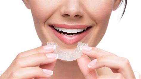 Is Invisalign® Better Than Braces Invisalign Pikesville Md