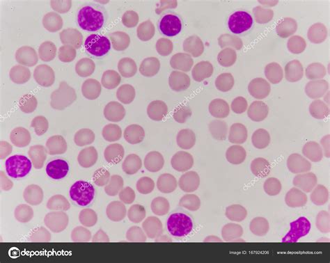 Blood cells finding with microscope. ⬇ Stock Photo, Image by © toeytoey ...