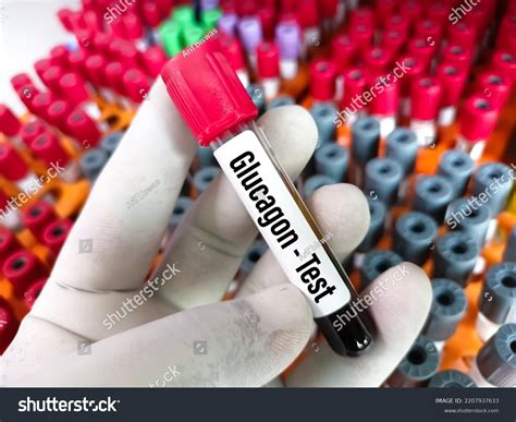 Blood Sample Tube Glucagon Test Pancreatitis Stock Photo 2207937633 ...