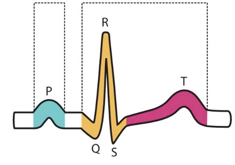 Normal Pattern Of Ekg Ii Diagram Quizlet