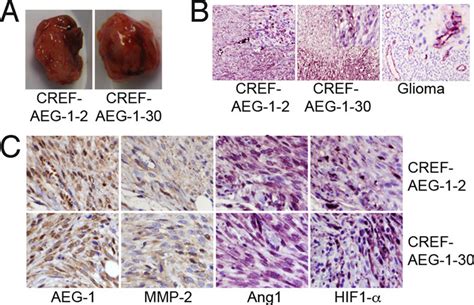 Histochemical Analysis Of Tumors Derived From Nude Mice Injected With