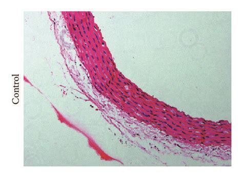 Von Kossa And Hematoxylin And Eosin He Staining For Aortic Sections Download Scientific