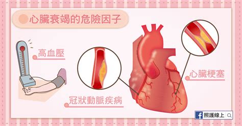 照護線上》心臟無力 愈來愈喘 心臟衰竭（懶人包） 自由評論網