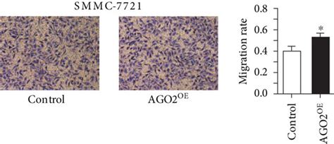 Ago2 Overexpression Promoted Proliferation And Migration Of Smmc 7721