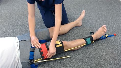 Traction Splint Application For Use In Femur Fractures Youtube