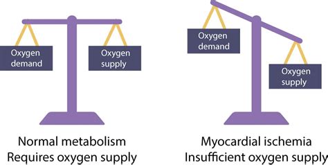 Myocardial Ischemia & infarction: Reactions, ECG Changes & Symptoms ...