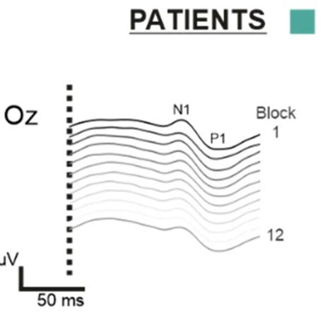 Resulting Visual Evoked Potentials Veps And Habituation To