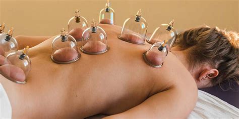 Hijama Cupping Therapy In Noida Kr Physiotherapy